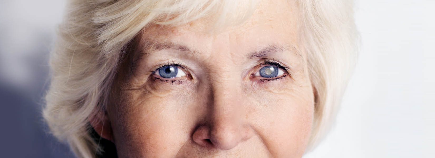 Cataract Surgery in Katy